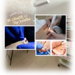 Tırnak Teli Uygulaması