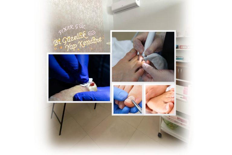 Tırnak Teli Uygulaması Yenikent Sincan Pınar Gül Güzellik Merkezi