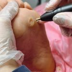 Ayak bakımı Nasır